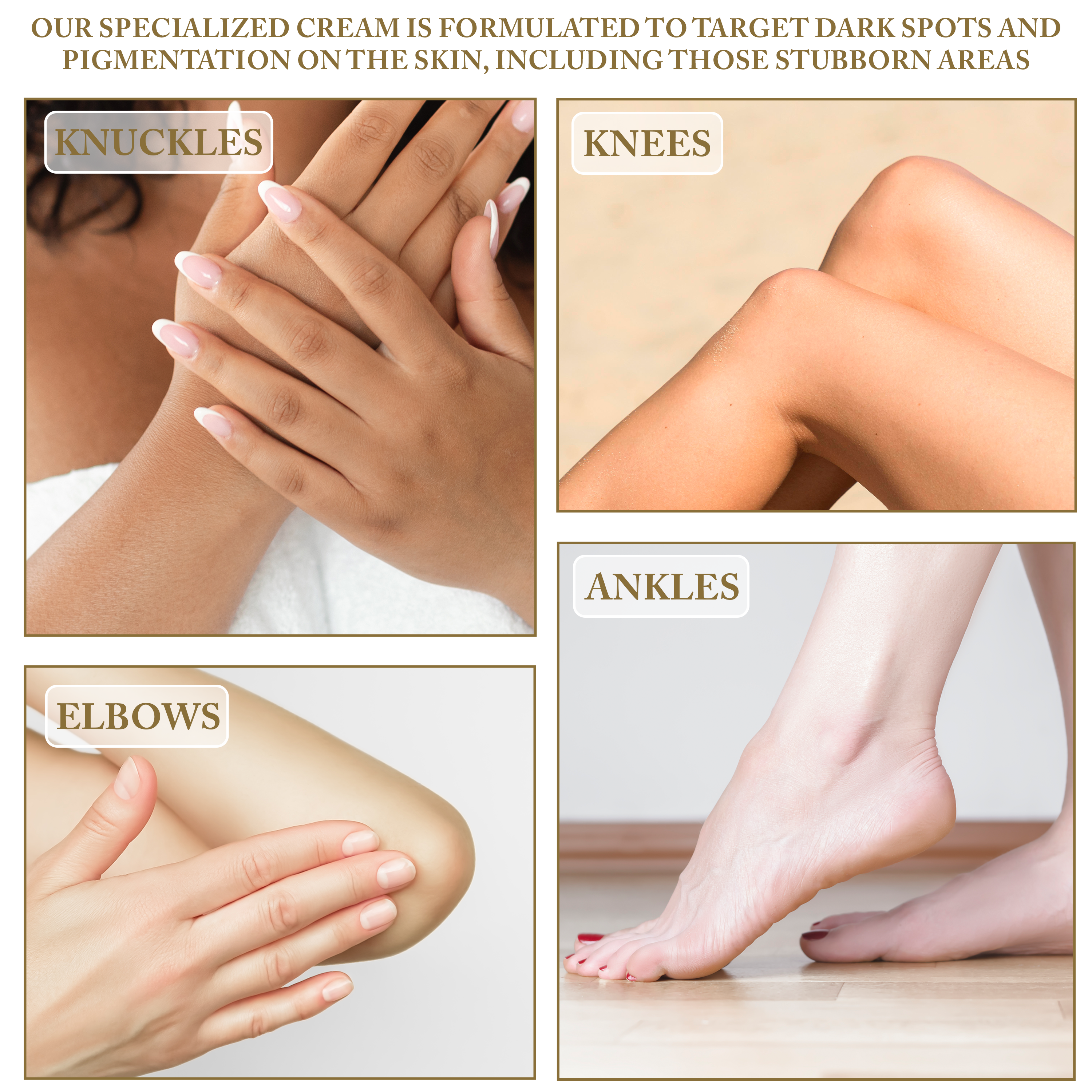 Dark Knuckles Knees & Elbows Lightening Cream