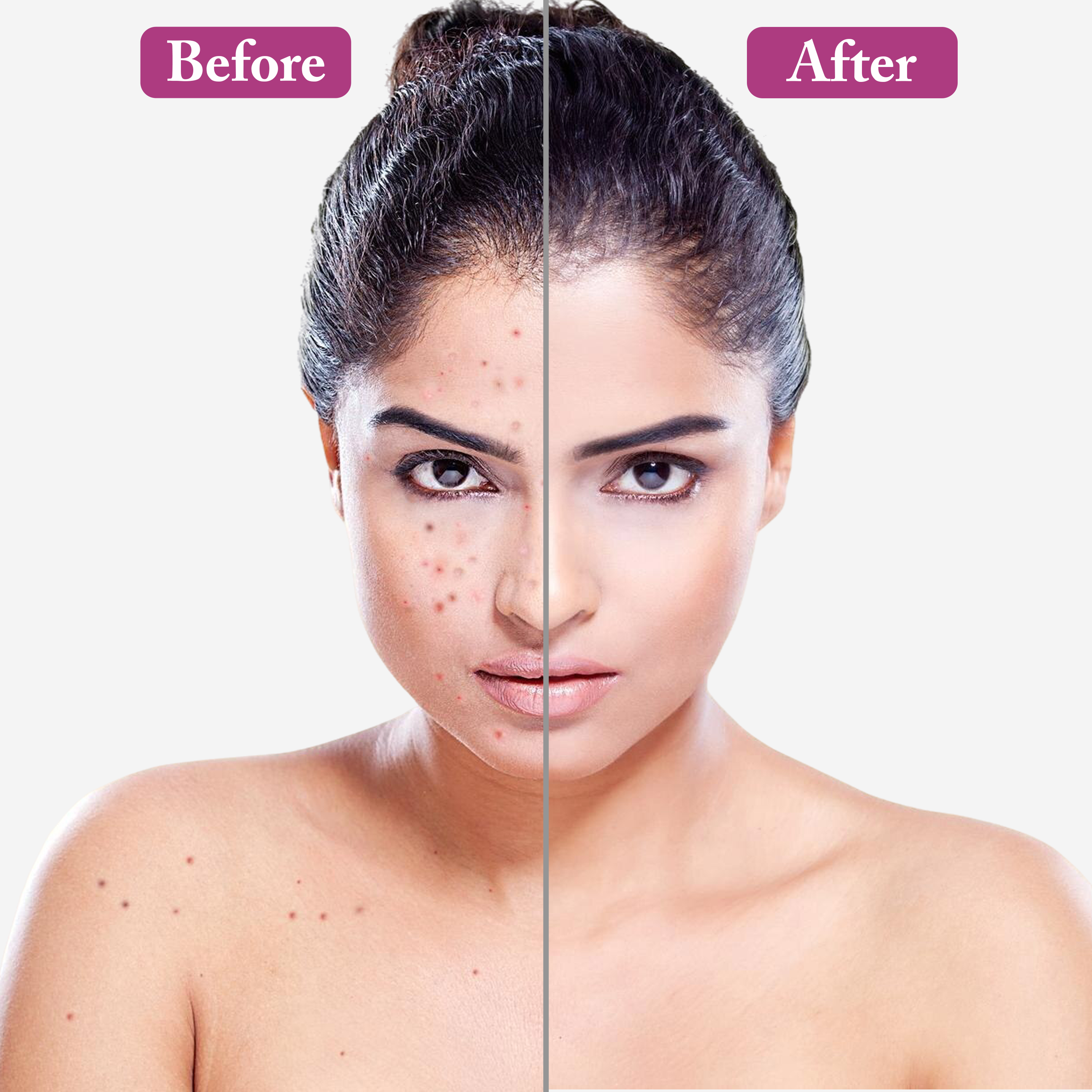 2choukay Face Whitening Cream