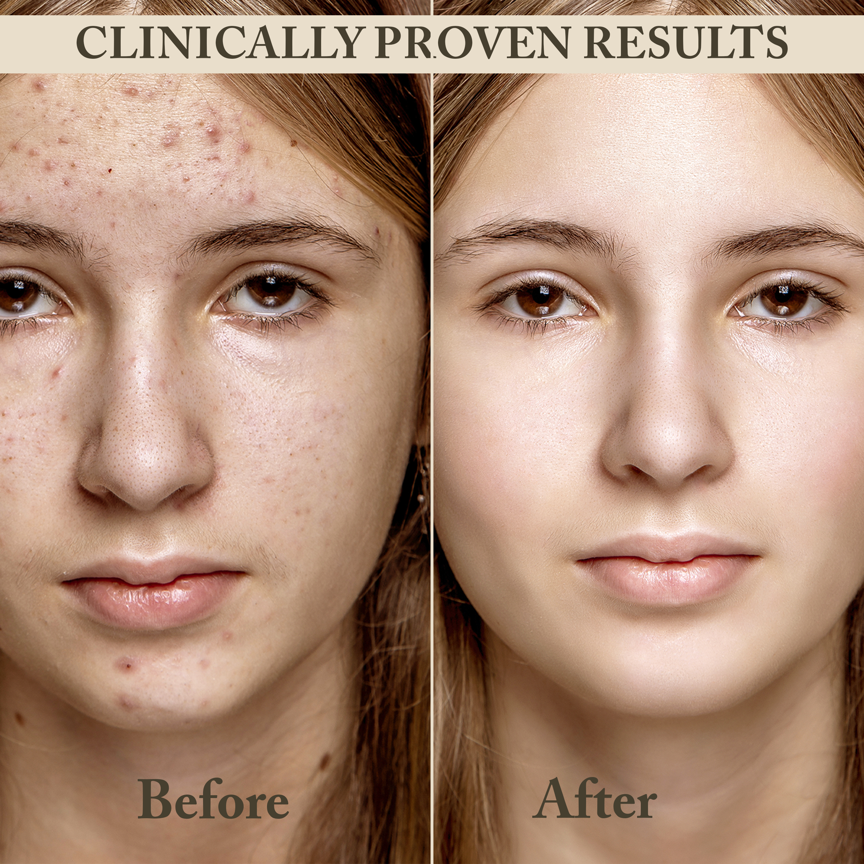 Dark Spot Remover