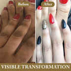 Blondelight Knuckle Eraser Oil