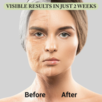 Visible results in just 2 weeks: before and after photo showcasing the effects of Vitamin C.