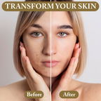 Before and after image showcasing skin transformation using the Supreme Set for visibly radiant results.